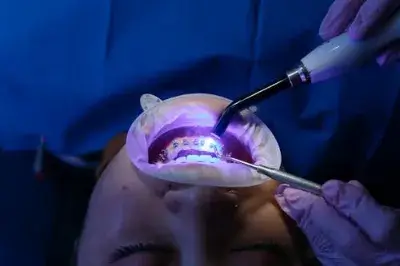 How a Shadowless LED Light Improves Dental Accuracy